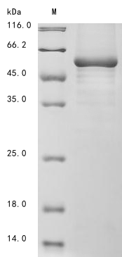 (Tris-Glycine gel) Discontinuous SDS-PAGE (reduced) with 5% enrichment gel and 15% separation gel.