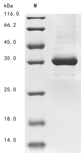 (Tris-Glycine gel) Discontinuous SDS-PAGE (reduced) with 5% enrichment gel and 15% separation gel.