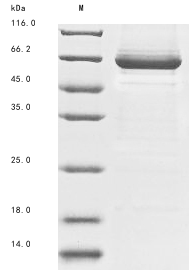 (Tris-Glycine gel) Discontinuous SDS-PAGE (reduced) with 5% enrichment gel and 15% separation gel.