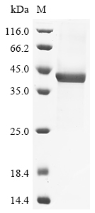 (Tris-Glycine gel) Discontinuous SDS-PAGE (reduced) with 5% enrichment gel and 15% separation gel.