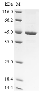 (Tris-Glycine gel) Discontinuous SDS-PAGE (reduced) with 5% enrichment gel and 15% separation gel.