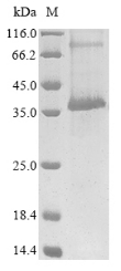 (Tris-Glycine gel) Discontinuous SDS-PAGE (reduced) with 5% enrichment gel and 15% separation gel.