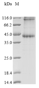 (Tris-Glycine gel) Discontinuous SDS-PAGE (reduced) with 5% enrichment gel and 15% separation gel.