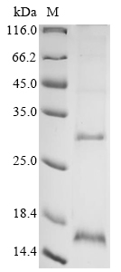 (Tris-Glycine gel) Discontinuous SDS-PAGE (reduced) with 5% enrichment gel and 15% separation gel.