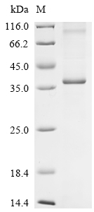 (Tris-Glycine gel) Discontinuous SDS-PAGE (reduced) with 5% enrichment gel and 15% separation gel.