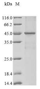 (Tris-Glycine gel) Discontinuous SDS-PAGE (reduced) with 5% enrichment gel and 15% separation gel.