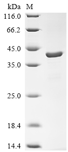 (Tris-Glycine gel) Discontinuous SDS-PAGE (reduced) with 5% enrichment gel and 15% separation gel.