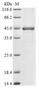 (Tris-Glycine gel) Discontinuous SDS-PAGE (reduced) with 5% enrichment gel and 15% separation gel.