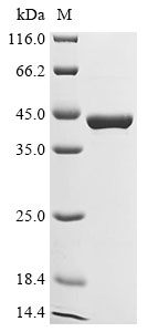 (Tris-Glycine gel) Discontinuous SDS-PAGE (reduced) with 5% enrichment gel and 15% separation gel.