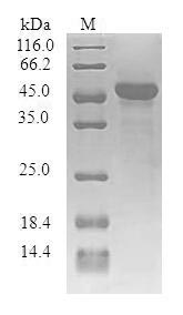 (Tris-Glycine gel) Discontinuous SDS-PAGE (reduced) with 5% enrichment gel and 15% separation gel.