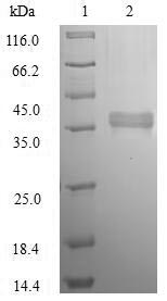 (Tris-Glycine gel) Discontinuous SDS-PAGE (reduced) with 5% enrichment gel and 15% separation gel.