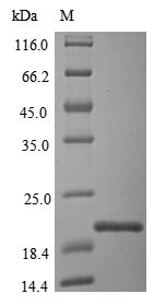 (Tris-Glycine gel) Discontinuous SDS-PAGE (reduced) with 5% enrichment gel and 15% separation gel.