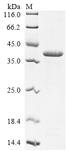 (Tris-Glycine gel) Discontinuous SDS-PAGE (reduced) with 5% enrichment gel and 15% separation gel.