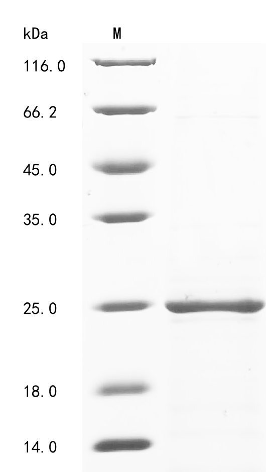 (Tris-Glycine gel) Discontinuous SDS-PAGE (reduced) with 5% enrichment gel and 15% separation gel.