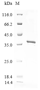 (Tris-Glycine gel) Discontinuous SDS-PAGE (reduced) with 5% enrichment gel and 15% separation gel.