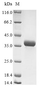 (Tris-Glycine gel) Discontinuous SDS-PAGE (reduced) with 5% enrichment gel and 15% separation gel.