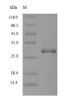 (Tris-Glycine gel) Discontinuous SDS-PAGE (reduced) with 5% enrichment gel and 15% separation gel.