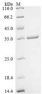 (Tris-Glycine gel) Discontinuous SDS-PAGE (reduced) with 5% enrichment gel and 15% separation gel.