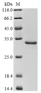 (Tris-Glycine gel) Discontinuous SDS-PAGE (reduced) with 5% enrichment gel and 15% separation gel.