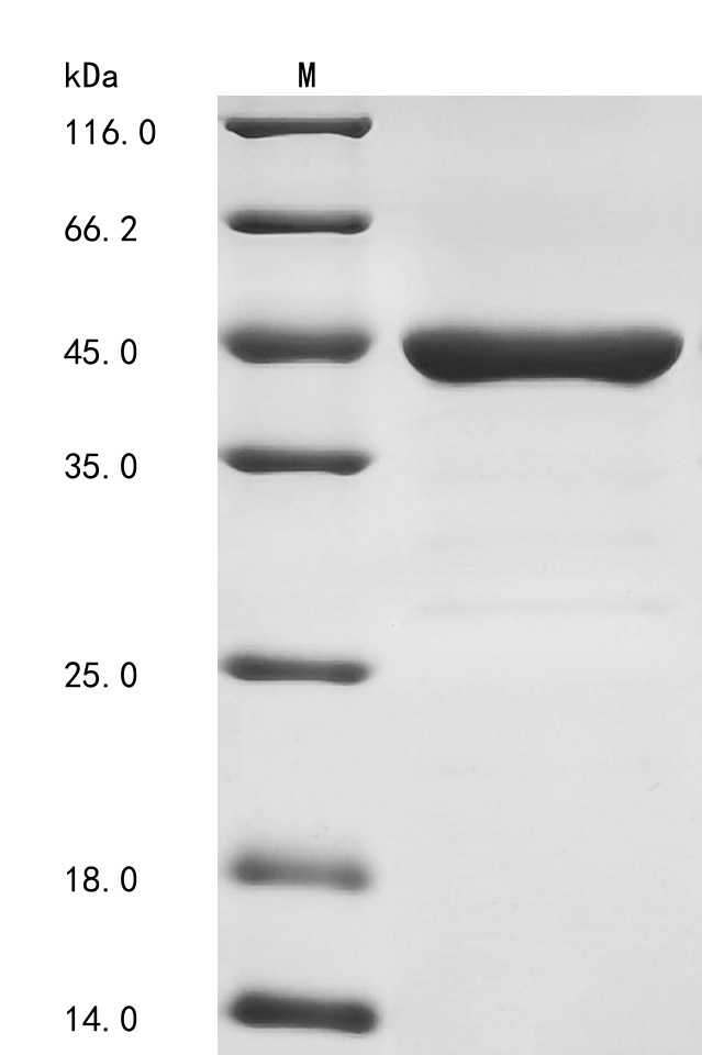 (Tris-Glycine gel) Discontinuous SDS-PAGE (reduced) with 5% enrichment gel and 15% separation gel.