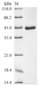 (Tris-Glycine gel) Discontinuous SDS-PAGE (reduced) with 5% enrichment gel and 15% separation gel.