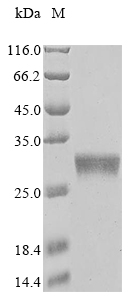 (Tris-Glycine gel) Discontinuous SDS-PAGE (reduced) with 5% enrichment gel and 15% separation gel.