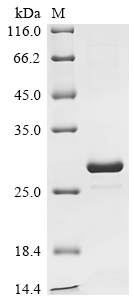 (Tris-Glycine gel) Discontinuous SDS-PAGE (reduced) with 5% enrichment gel and 15% separation gel.