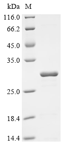 (Tris-Glycine gel) Discontinuous SDS-PAGE (reduced) with 5% enrichment gel and 15% separation gel.