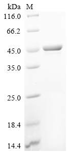 (Tris-Glycine gel) Discontinuous SDS-PAGE (reduced) with 5% enrichment gel and 15% separation gel.