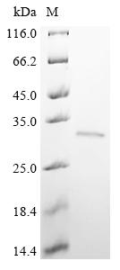 (Tris-Glycine gel) Discontinuous SDS-PAGE (reduced) with 5% enrichment gel and 15% separation gel.