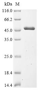 (Tris-Glycine gel) Discontinuous SDS-PAGE (reduced) with 5% enrichment gel and 15% separation gel.