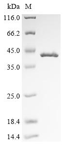 (Tris-Glycine gel) Discontinuous SDS-PAGE (reduced) with 5% enrichment gel and 15% separation gel.