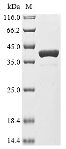 (Tris-Glycine gel) Discontinuous SDS-PAGE (reduced) with 5% enrichment gel and 15% separation gel.