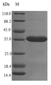 (Tris-Glycine gel) Discontinuous SDS-PAGE (reduced) with 5% enrichment gel and 15% separation gel.