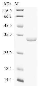 (Tris-Glycine gel) Discontinuous SDS-PAGE (reduced) with 5% enrichment gel and 15% separation gel.