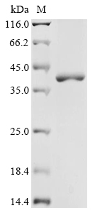 (Tris-Glycine gel) Discontinuous SDS-PAGE (reduced) with 5% enrichment gel and 15% separation gel.