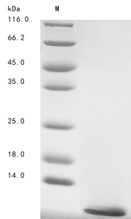 (Tris-Glycine gel) Discontinuous SDS-PAGE (reduced) with 5% enrichment gel and 15% separation gel.