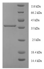 (Tris-Glycine gel) Discontinuous SDS-PAGE (reduced) with 5% enrichment gel and 15% separation gel.