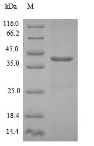 (Tris-Glycine gel) Discontinuous SDS-PAGE (reduced) with 5% enrichment gel and 15% separation gel.