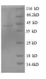 (Tris-Glycine gel) Discontinuous SDS-PAGE (reduced) with 5% enrichment gel and 15% separation gel.