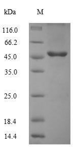 (Tris-Glycine gel) Discontinuous SDS-PAGE (reduced) with 5% enrichment gel and 15% separation gel.