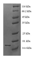 (Tris-Glycine gel) Discontinuous SDS-PAGE (reduced) with 5% enrichment gel and 15% separation gel.