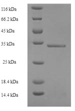 (Tris-Glycine gel) Discontinuous SDS-PAGE (reduced) with 5% enrichment gel and 15% separation gel.