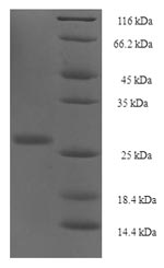 (Tris-Glycine gel) Discontinuous SDS-PAGE (reduced) with 5% enrichment gel and 15% separation gel.