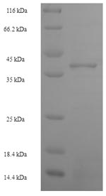 (Tris-Glycine gel) Discontinuous SDS-PAGE (reduced) with 5% enrichment gel and 15% separation gel.