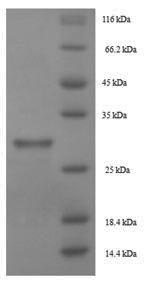 (Tris-Glycine gel) Discontinuous SDS-PAGE (reduced) with 5% enrichment gel and 15% separation gel.