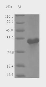 (Tris-Glycine gel) Discontinuous SDS-PAGE (reduced) with 5% enrichment gel and 15% separation gel.