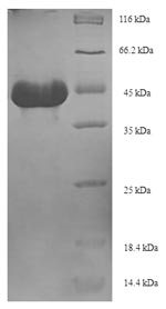 (Tris-Glycine gel) Discontinuous SDS-PAGE (reduced) with 5% enrichment gel and 15% separation gel.