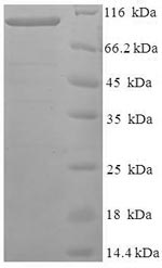 (Tris-Glycine gel) Discontinuous SDS-PAGE (reduced) with 5% enrichment gel and 15% separation gel.