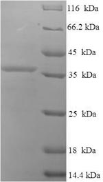 (Tris-Glycine gel) Discontinuous SDS-PAGE (reduced) with 5% enrichment gel and 15% separation gel.